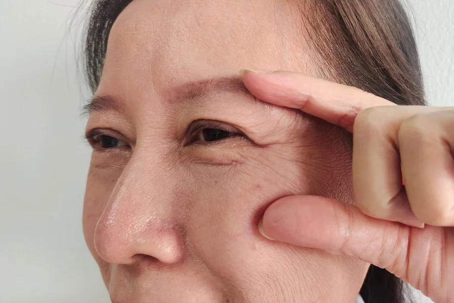 Collagen Loss In Face Causes, Signs, and Care Tips